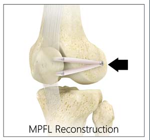 Non-Surgical Knee Treatments